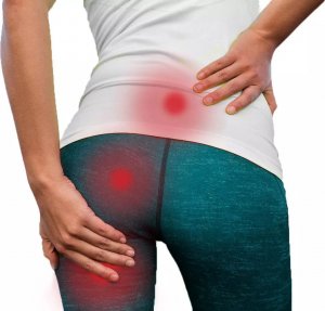 Região lombar e glútea com pontos de dor causados por ciatalgia