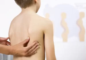 Médico examinando criança com suspeita de escoliose congênita