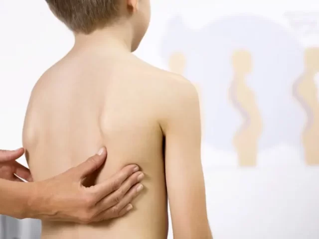 Médico examinando criança com suspeita de escoliose congênita