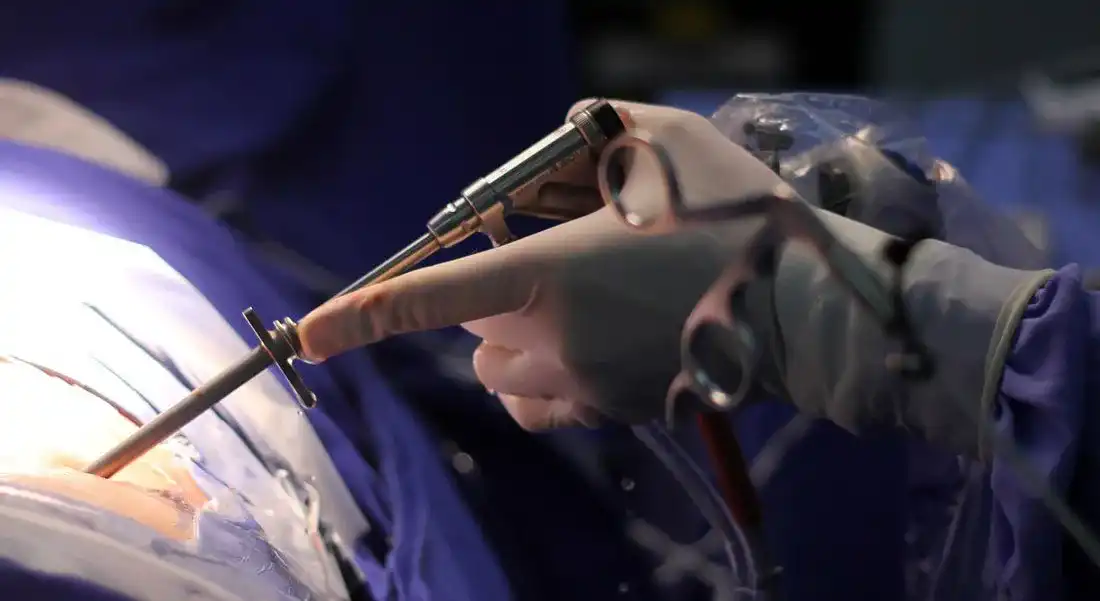 Imagem de uma cirurgia de endoscopia de coluna